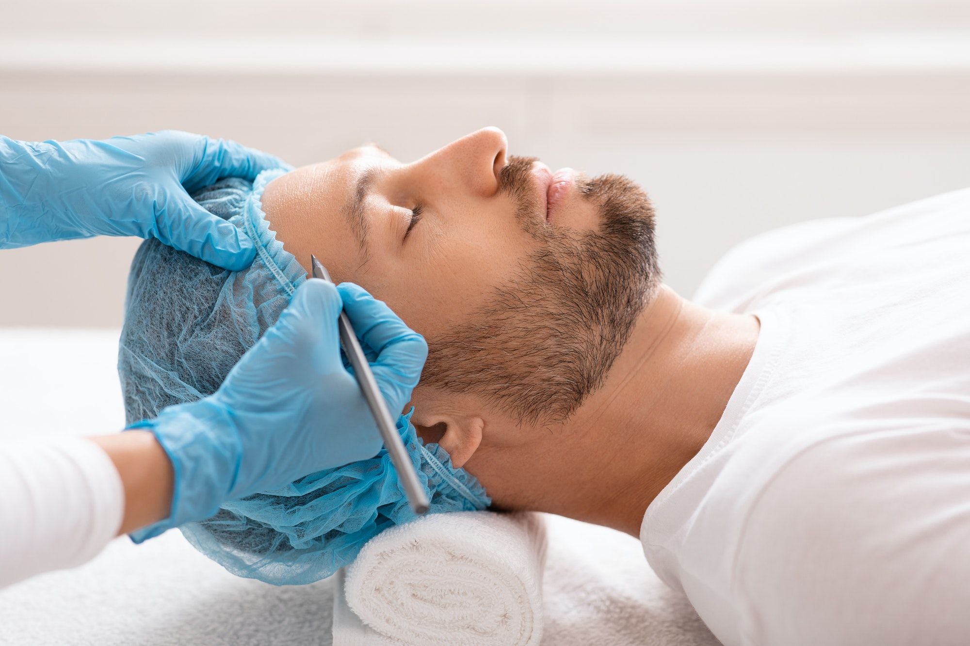 handsome-man-getting-pencil-marks-on-forehead-before-surgery.jpg