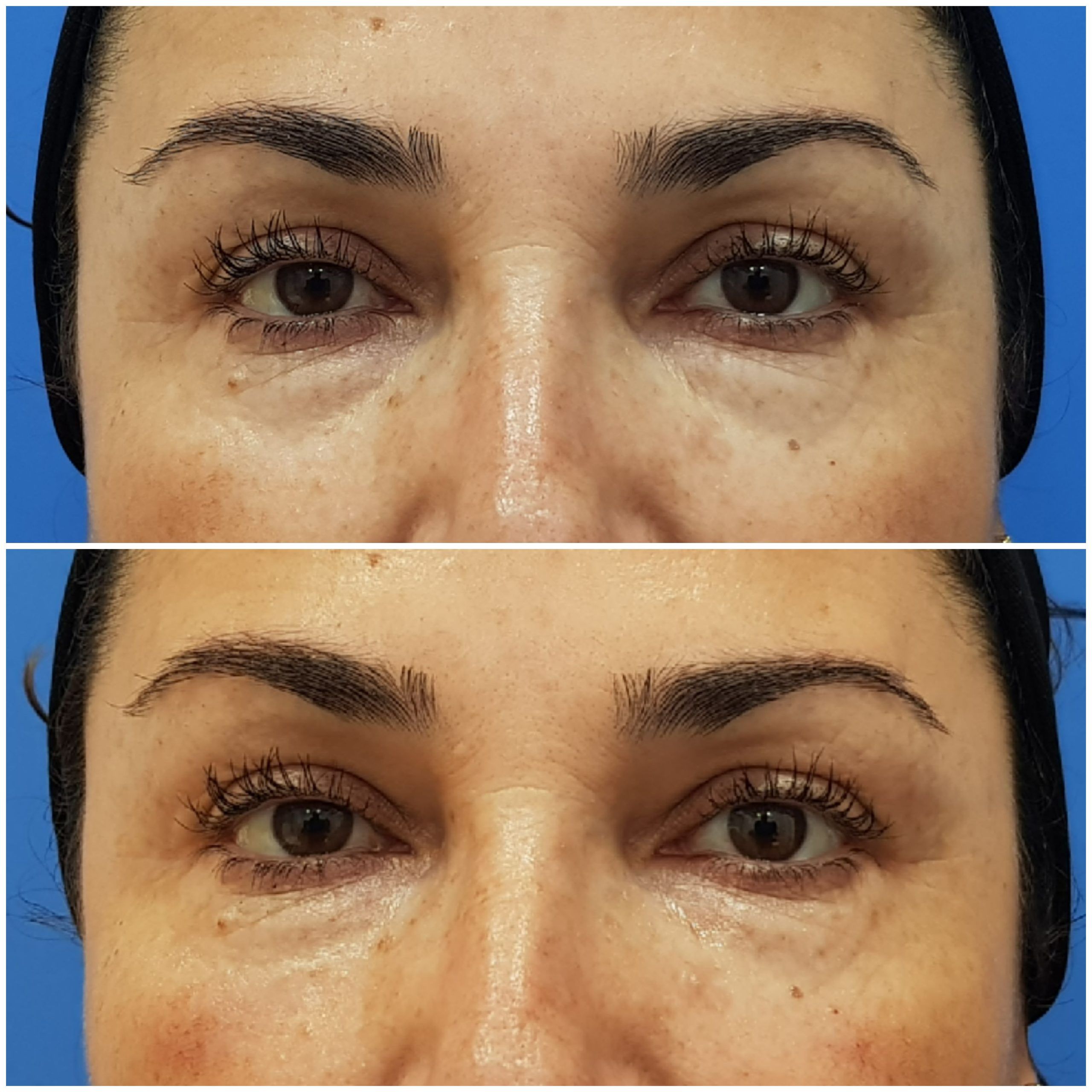 OJERAS (2)