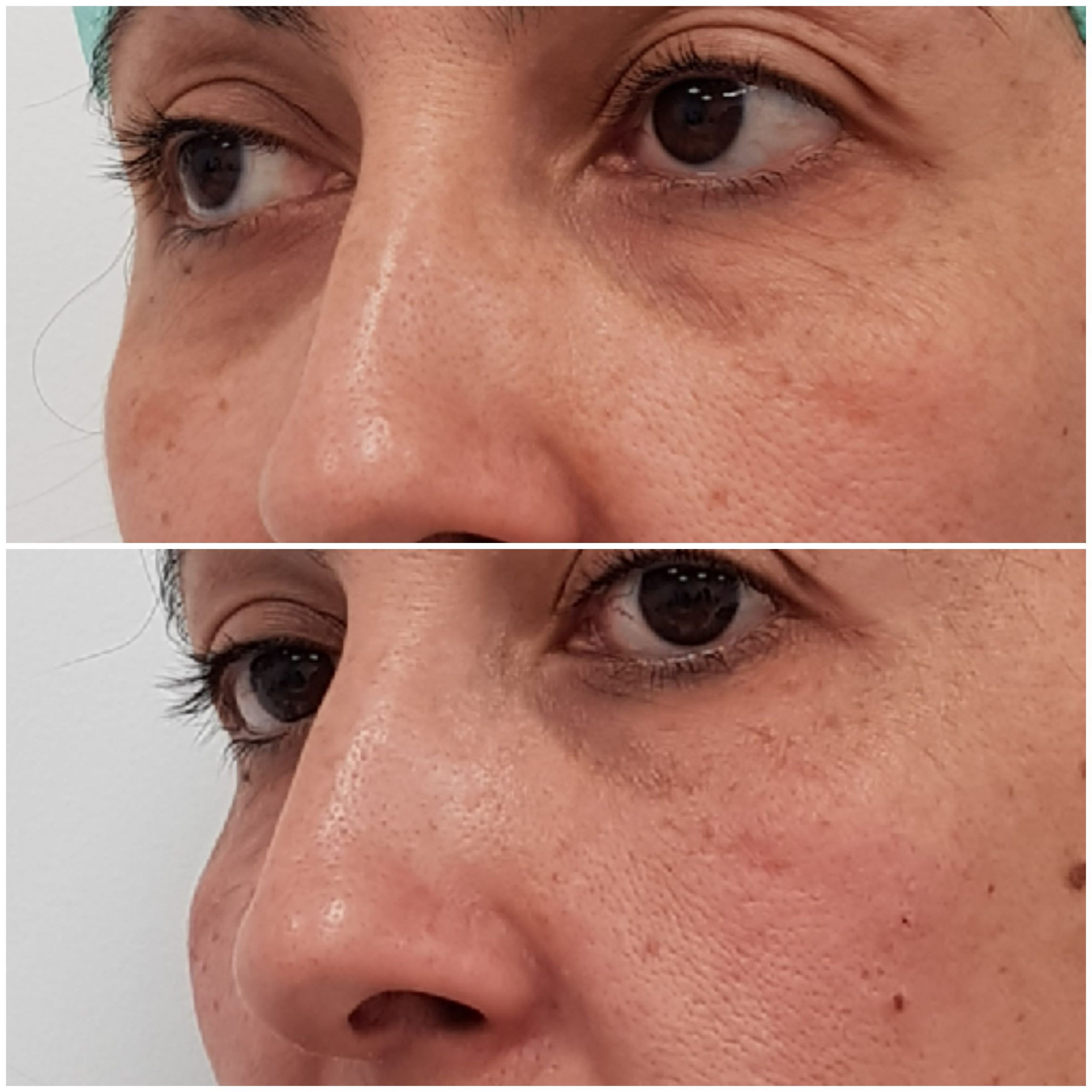 OJERAS (3)