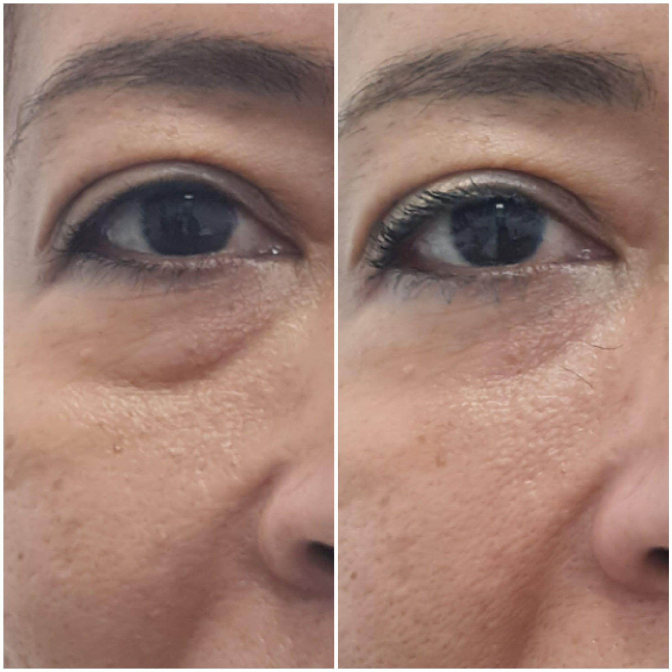 OJERAS (6)