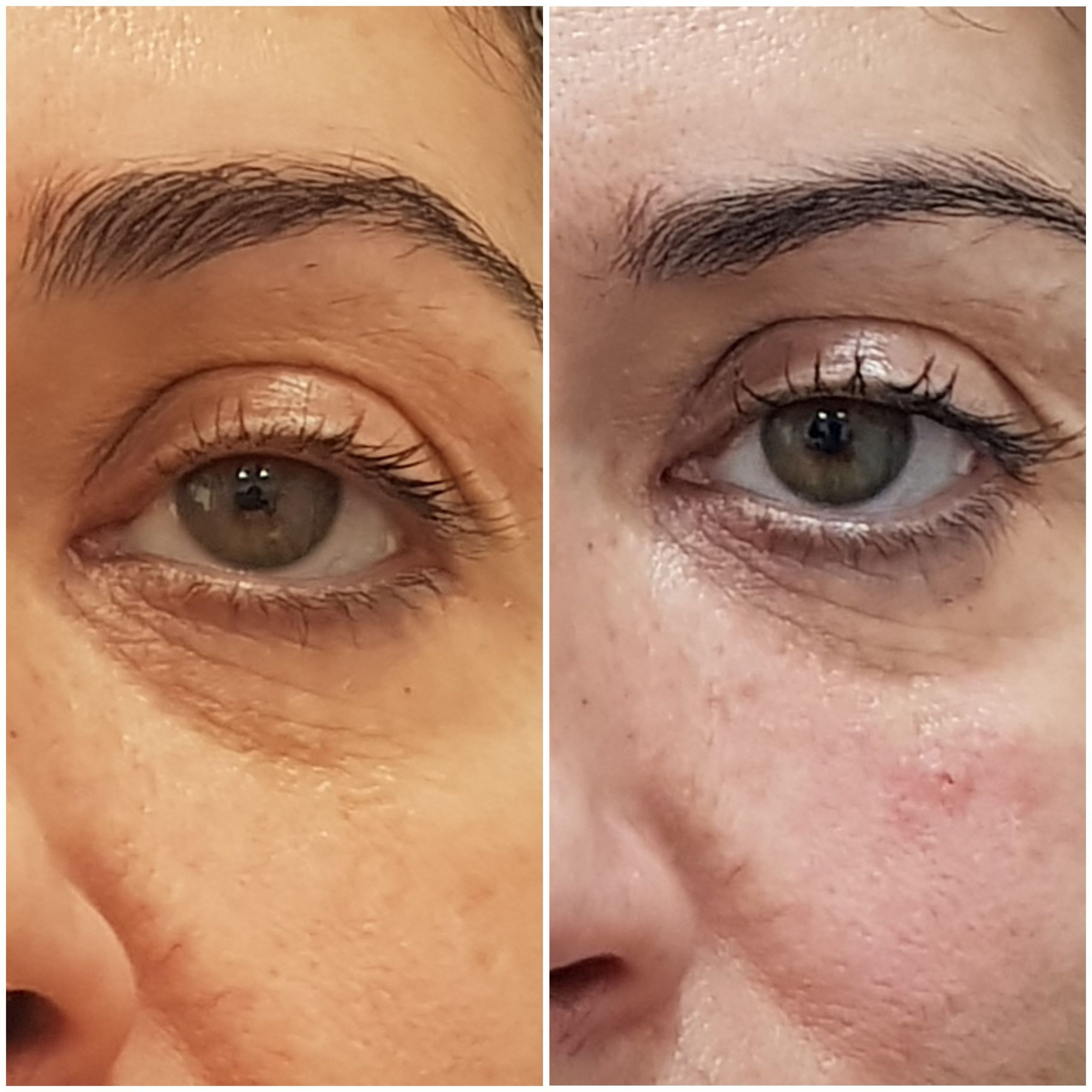 OJERAS